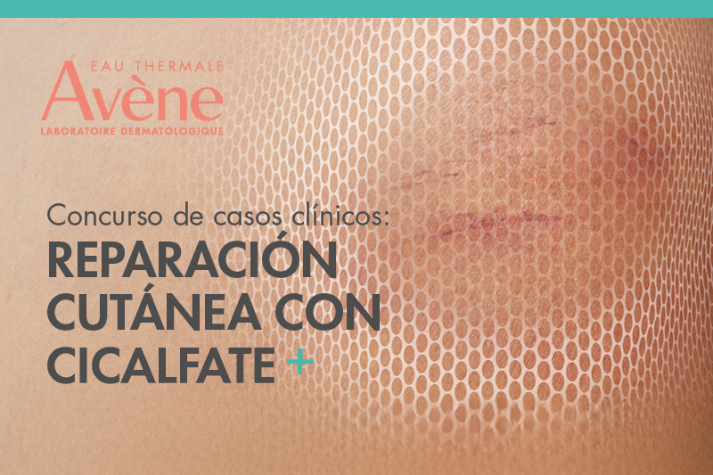 Concurso